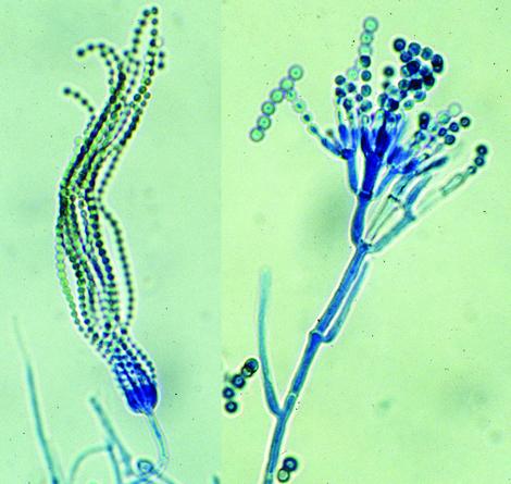 Penicillium micro