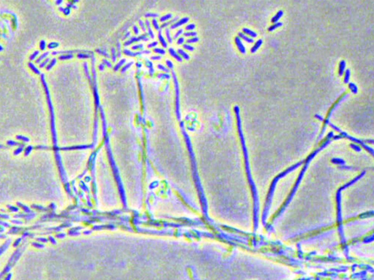 Acremonium sp. showing long awl-shaped phialides producing cylindrical, one-celled conidia mostly aggregated in slimy heads at the apex of each phialide.