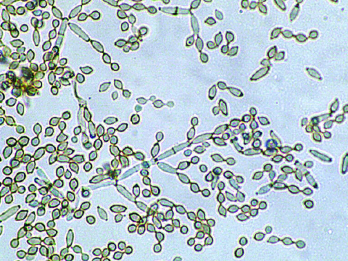 Conidiophores and conidia of Cladosporium cladosporioides
