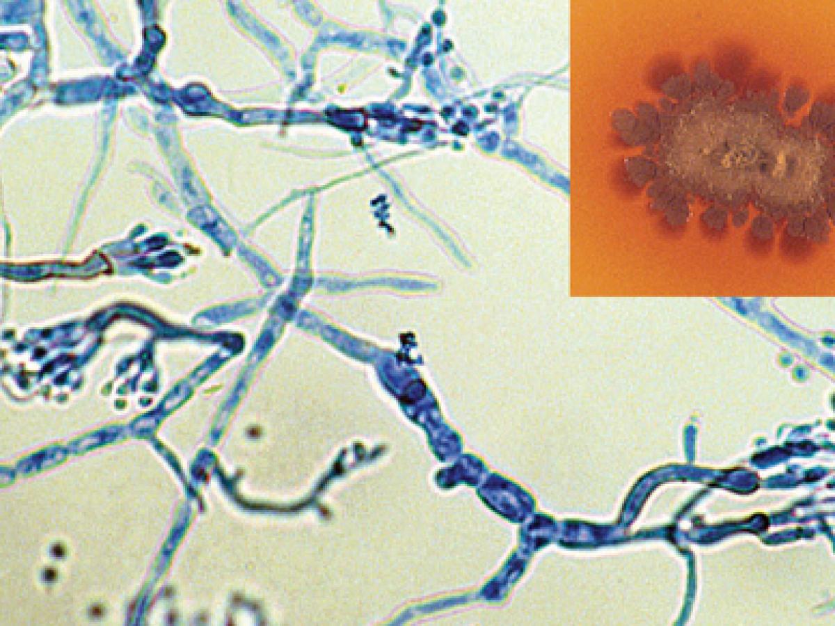 Culture showing the typical brown diffusable pigment in the agar and phialides of M. mycetomatis