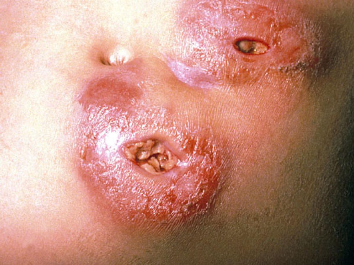 Unknown 02 clinical presentation