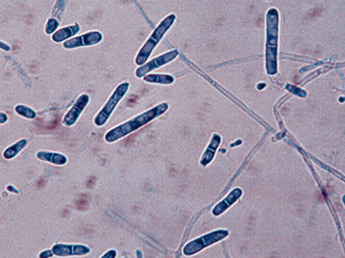 Arthroderma insingulare microscopy