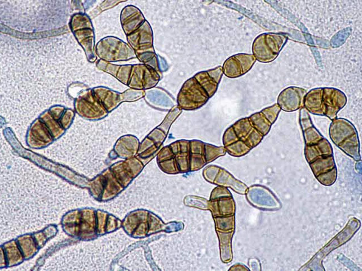 Alternaria conidia
