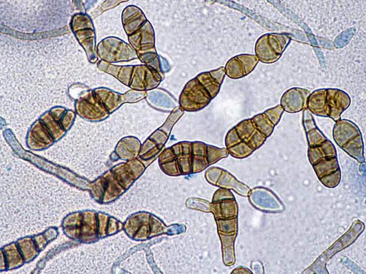 Alternaria conidia