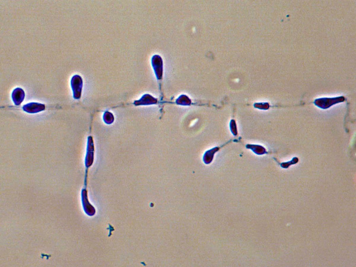 Aphanoascus microscopy