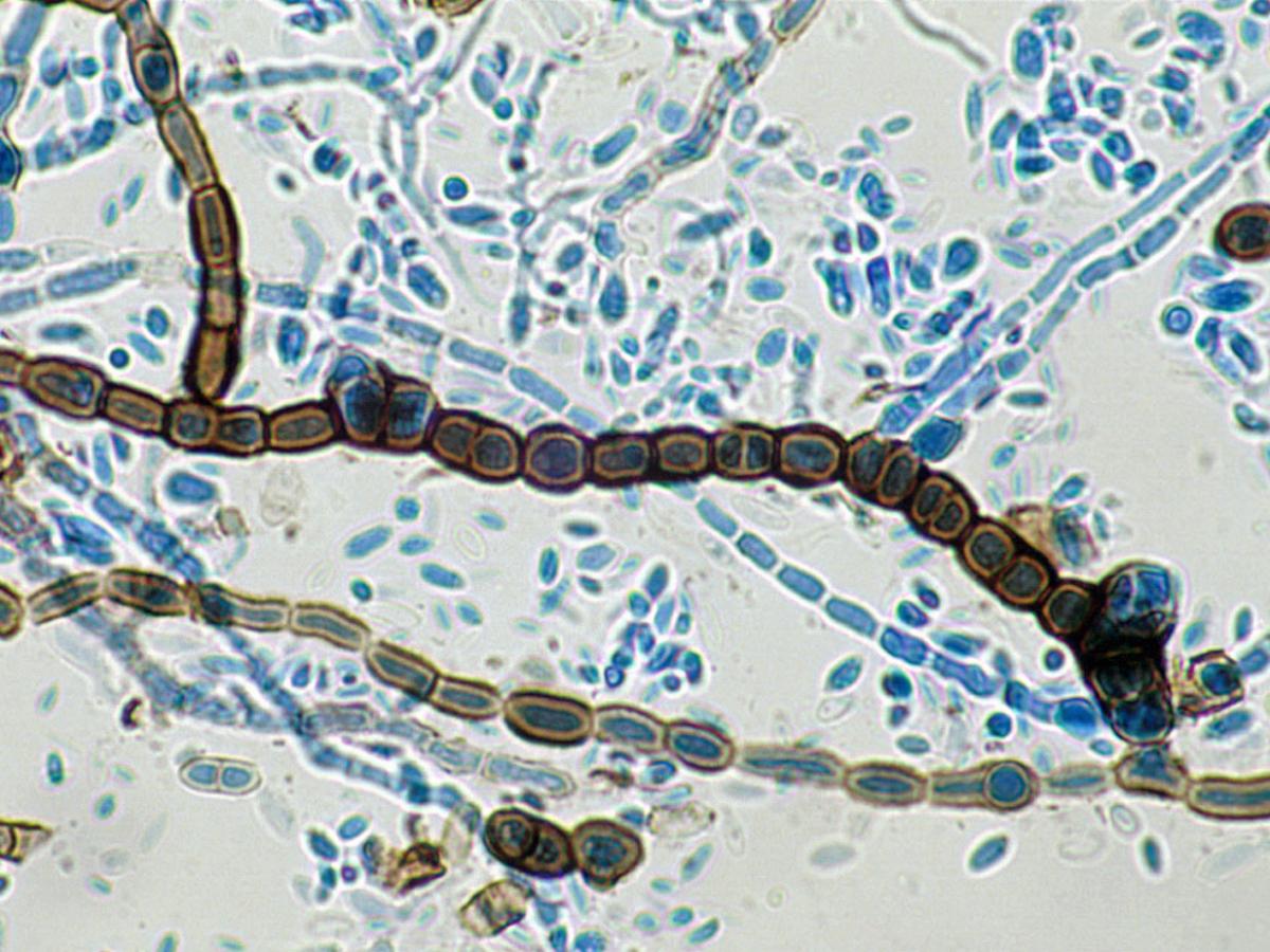 Aureobasidium pullulans microscopy