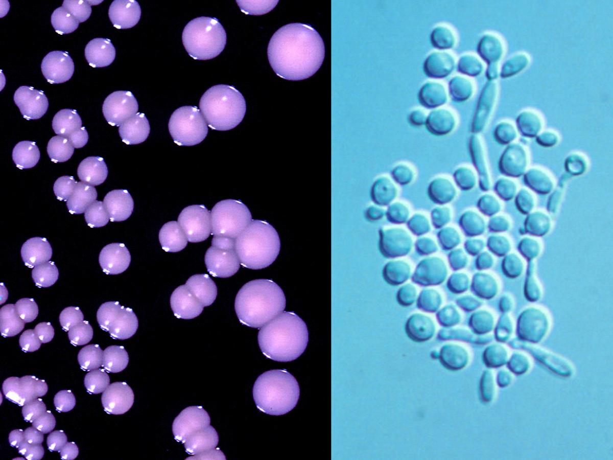 Typical moist colonies of Candida.