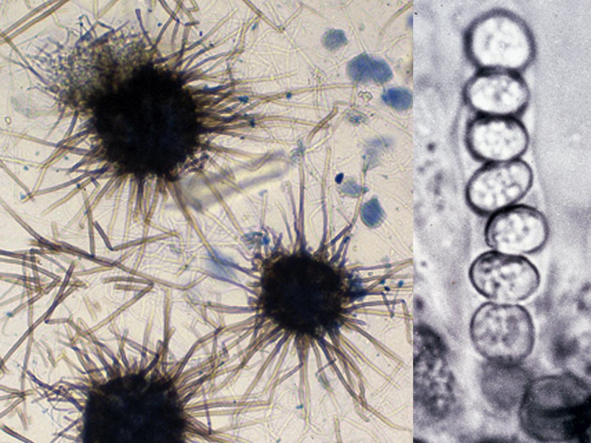 Chaetomium perithecium