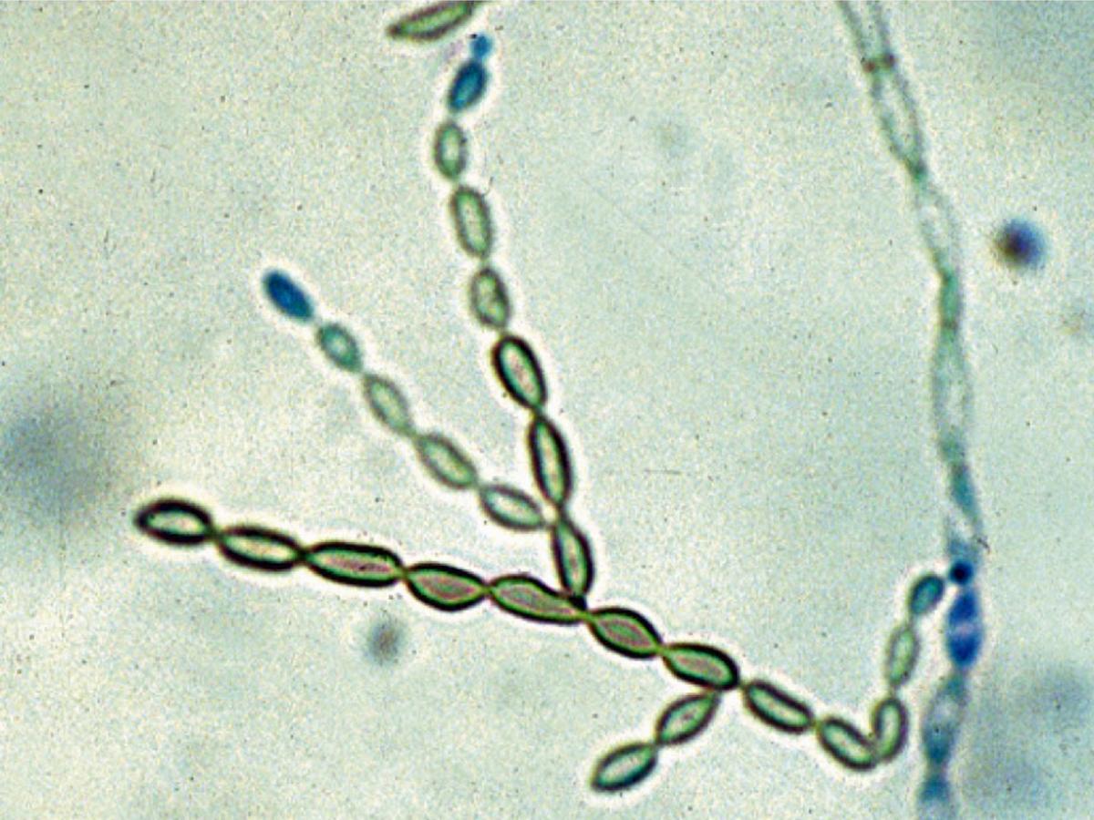 Cladophialophora bantiana conidiophore and conidia.