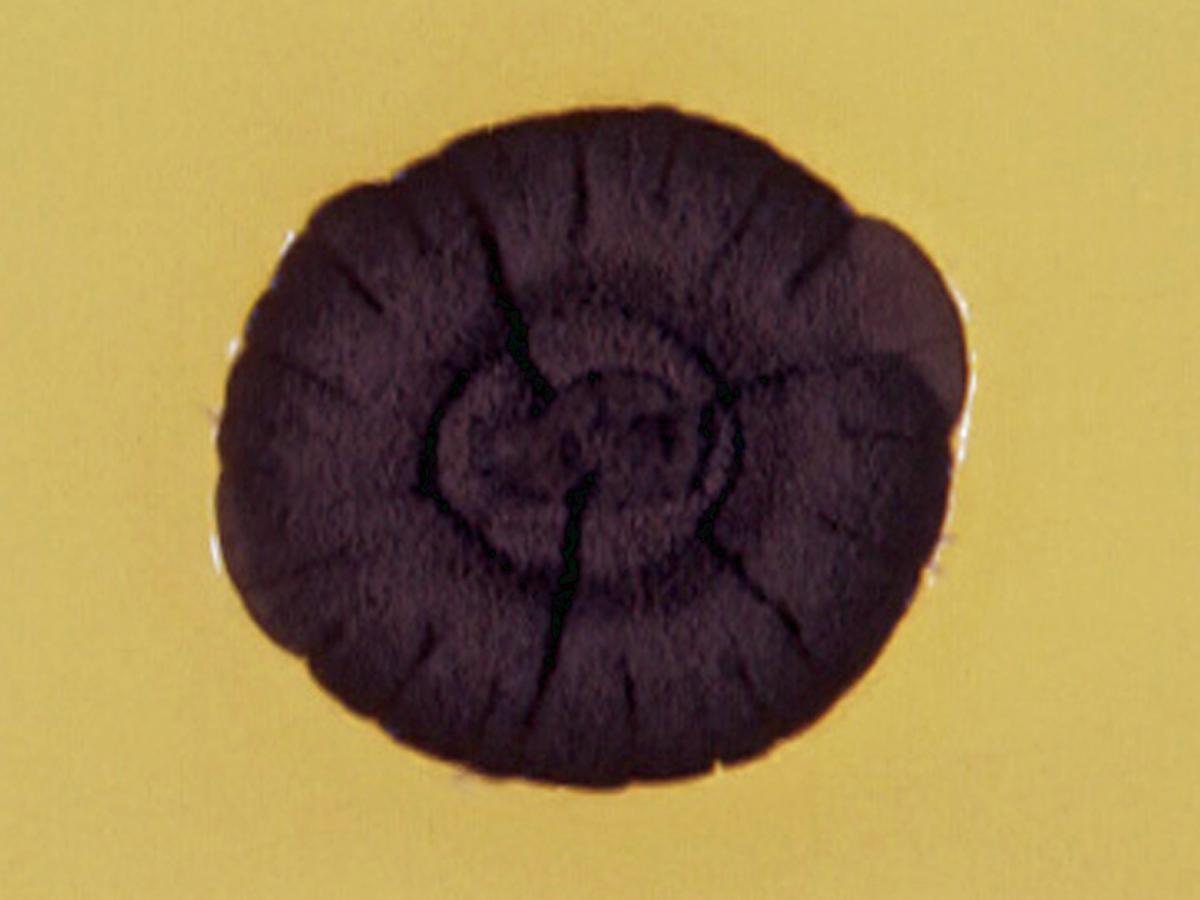 Culture of Cladophialophora carrionii.
