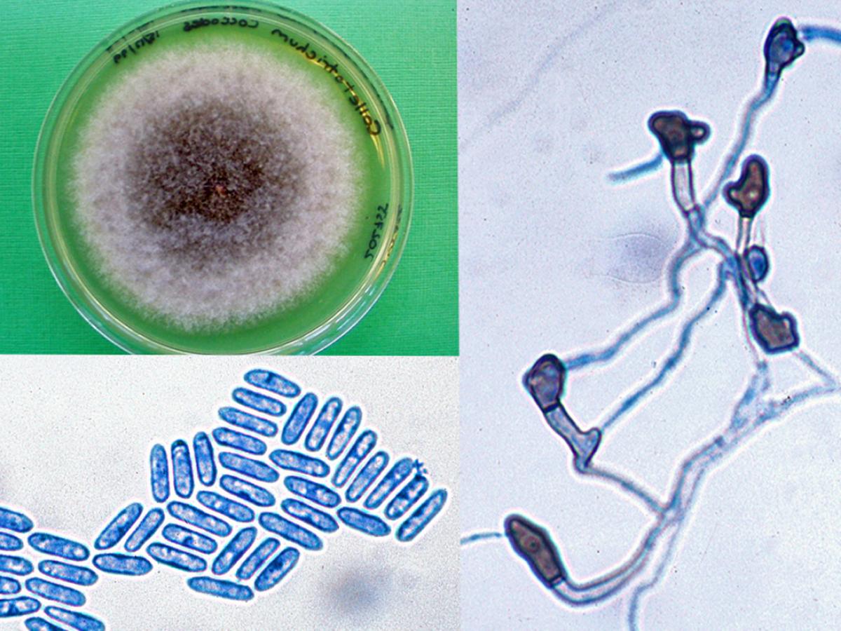 Colletotrichum culture