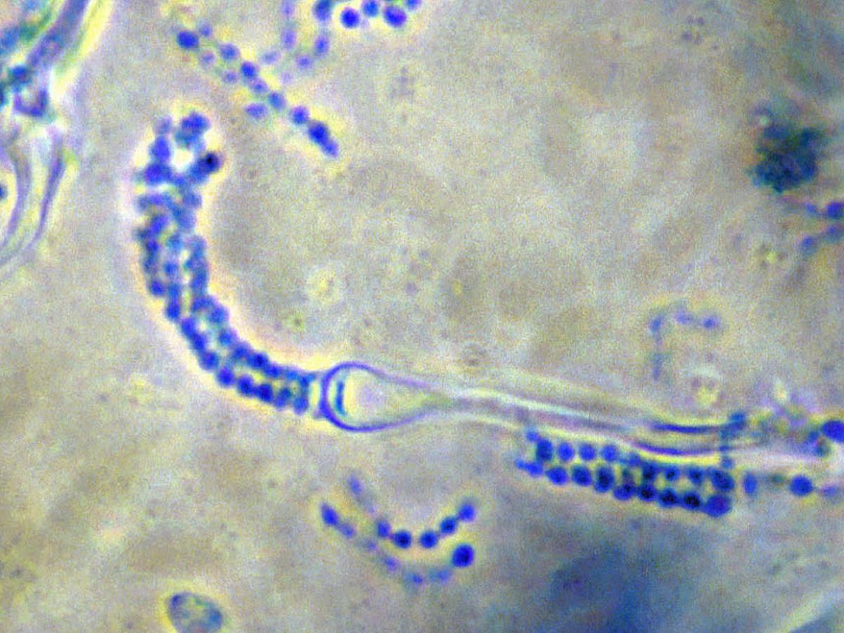 Cryptococcus neoformans basidiospore