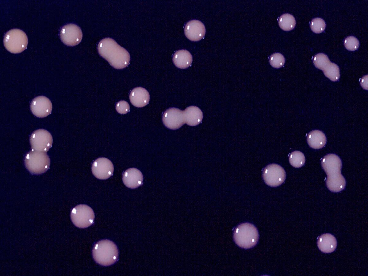 Cryptococcus neoformans culture