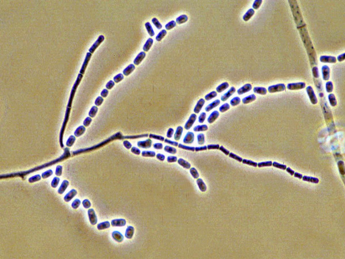 Geotrichum candidum arthroconidium formation.