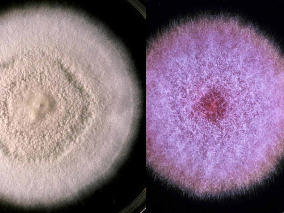 Hyaline hyphomycetes