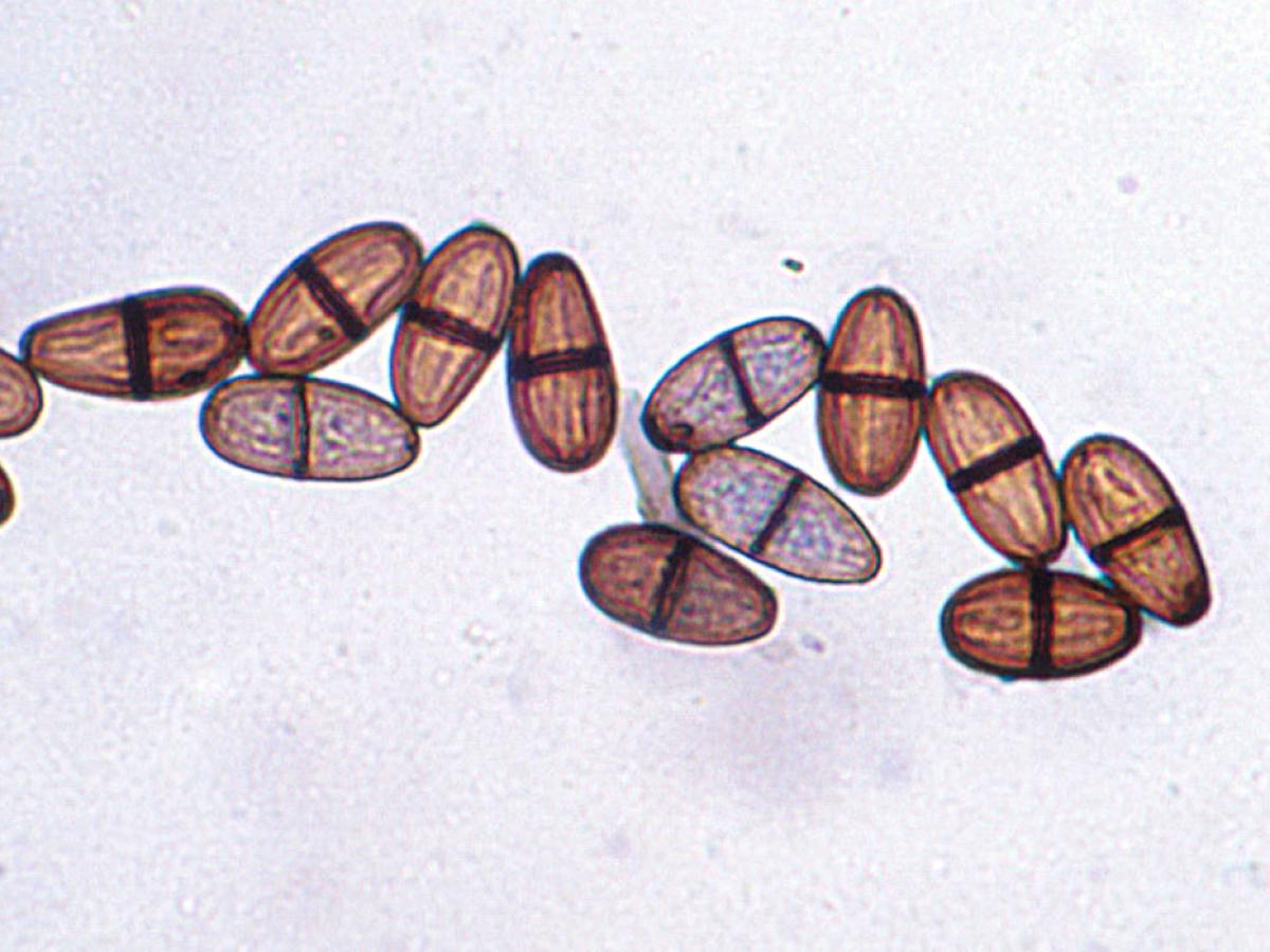 Lasiodiplodia microscopy