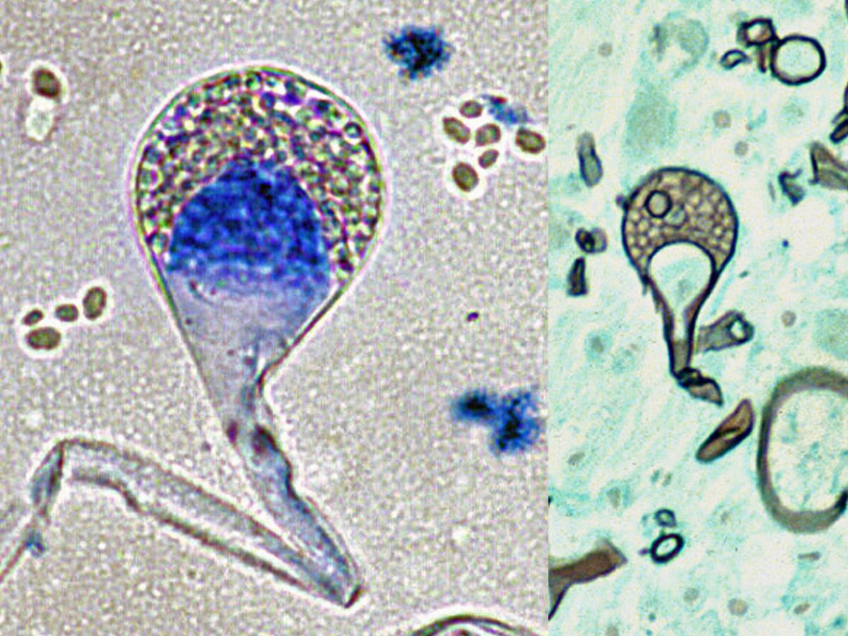 Lichtheimia microscop[y