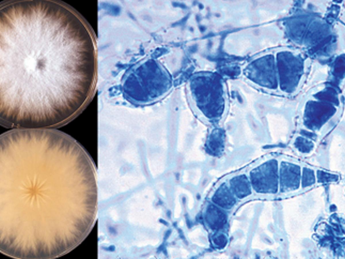 Microsporum canis distortum