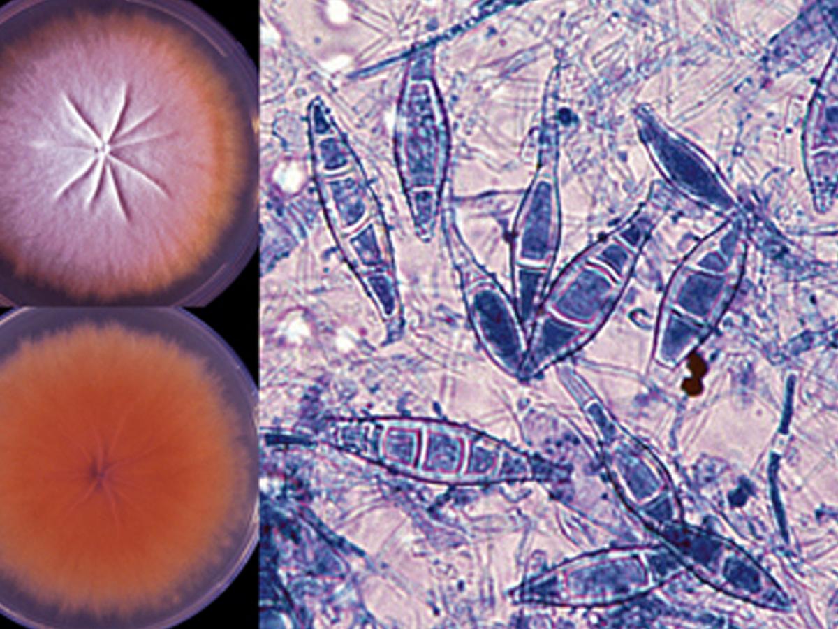 Microsporum canis equinum