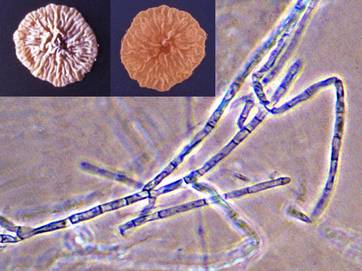 Microsporum ferrugineum