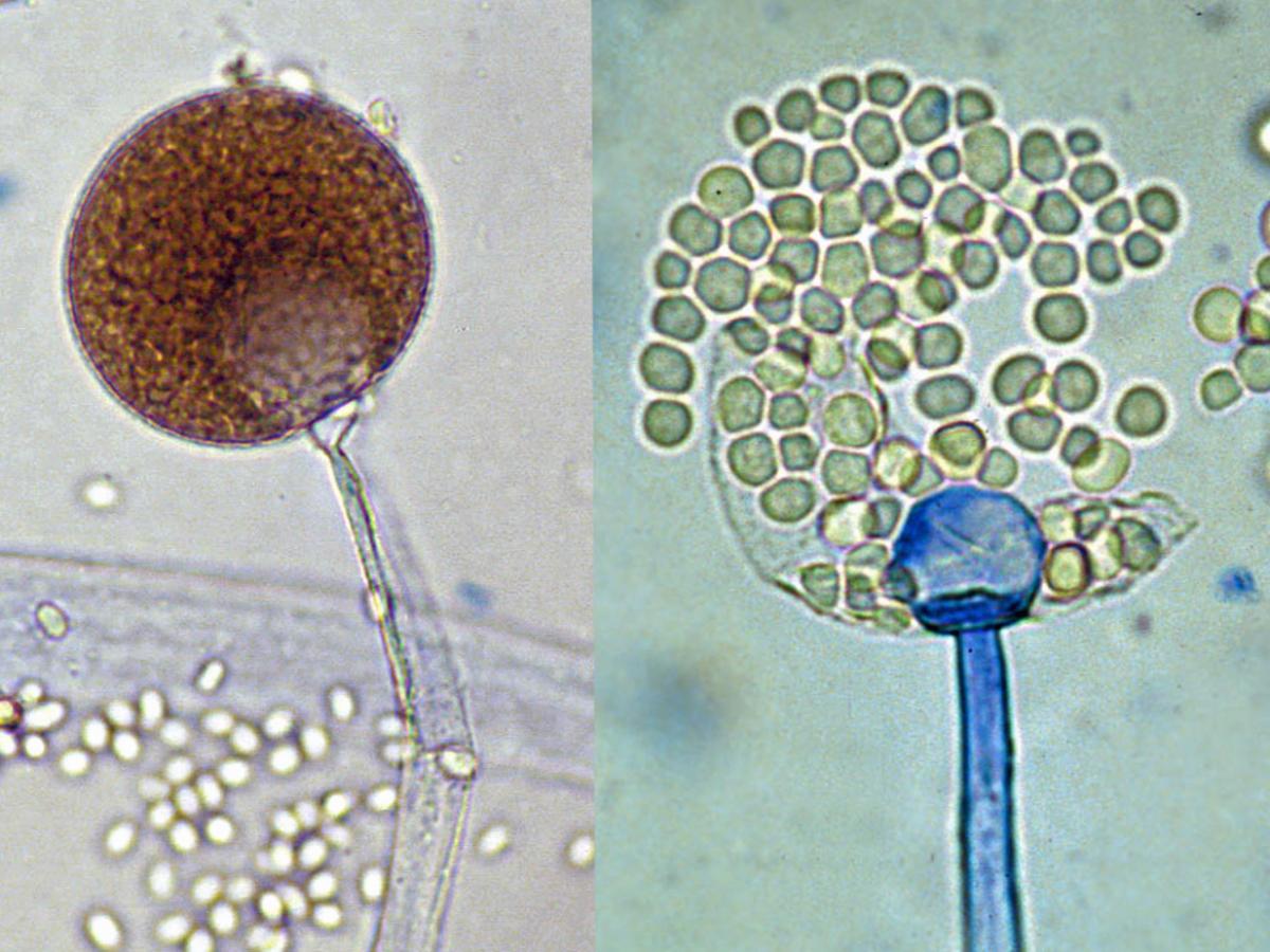 Mucor sporangia