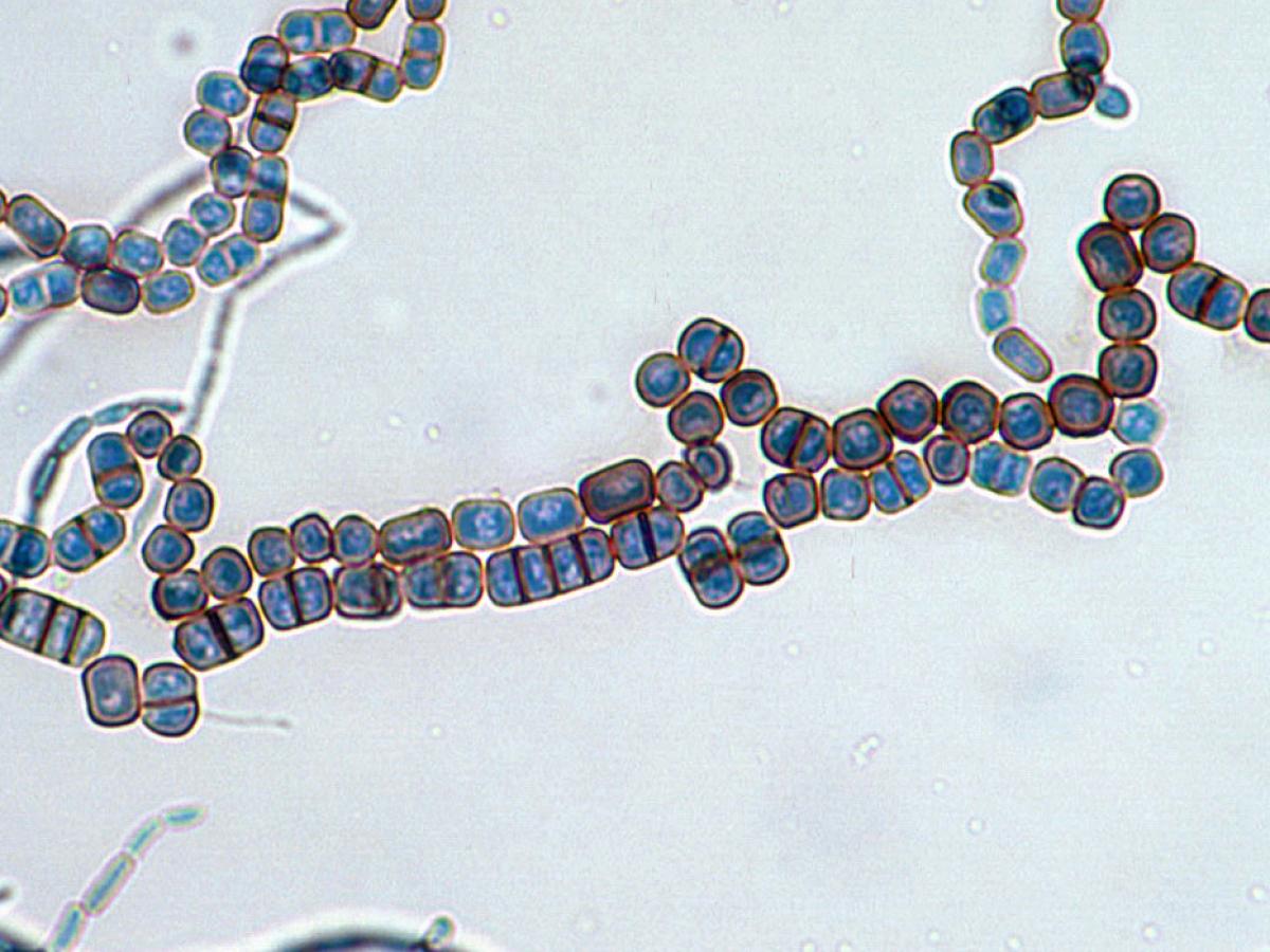 Neoscytalidium microscopy