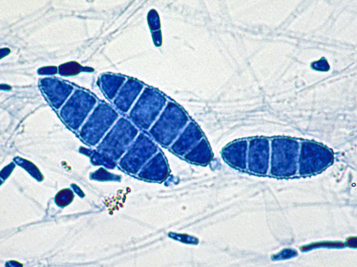 Nannizzia gypsea microscopy