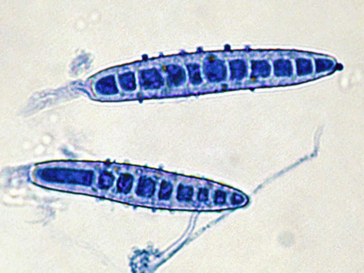 Paraphyton cookie microscopy