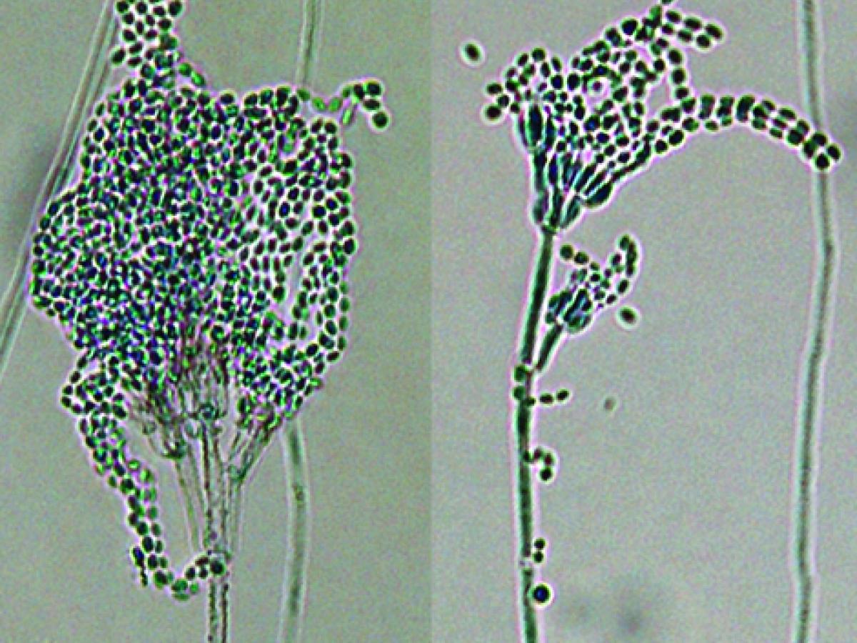 Purpureocillium lilacinum microscopy