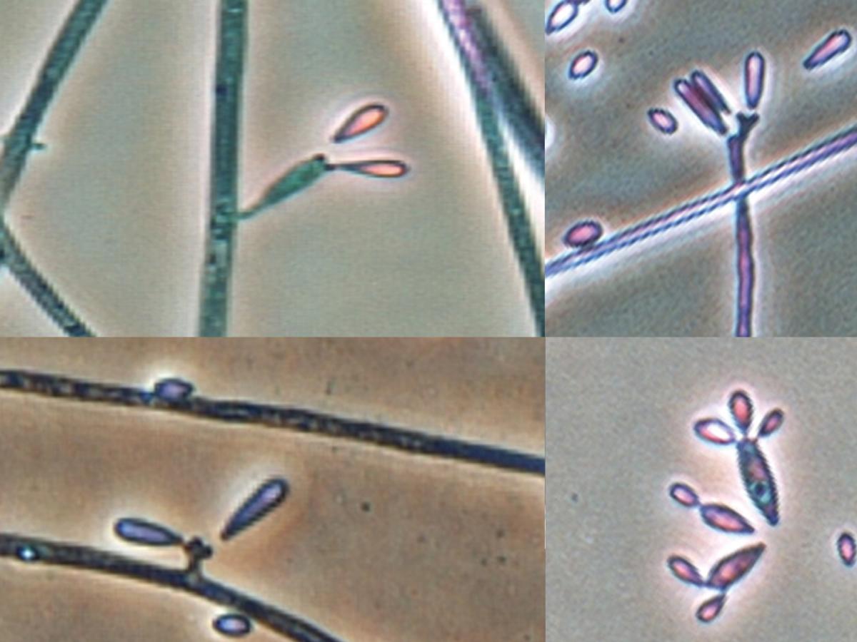 Quambalaria cyanescens microscopy