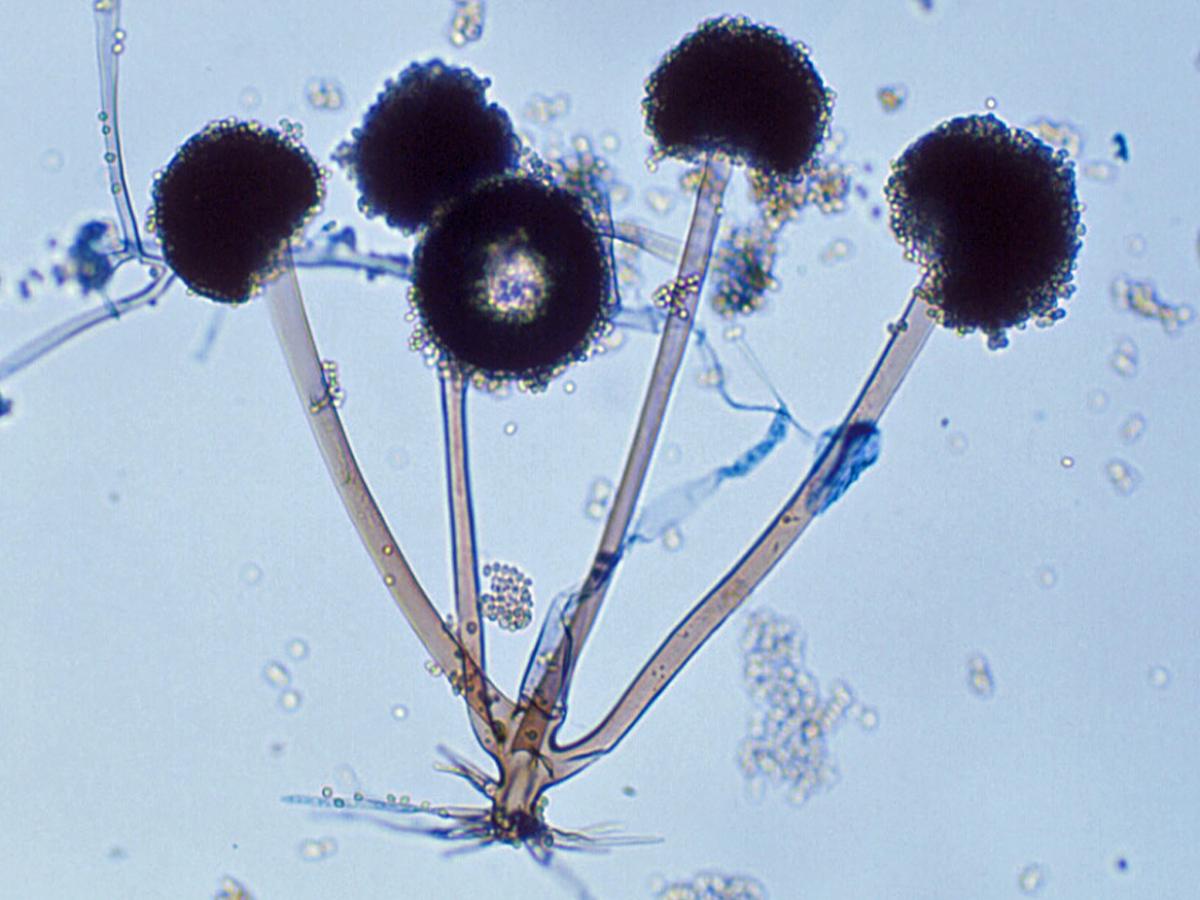 Rhizopus arrhizus microscopy