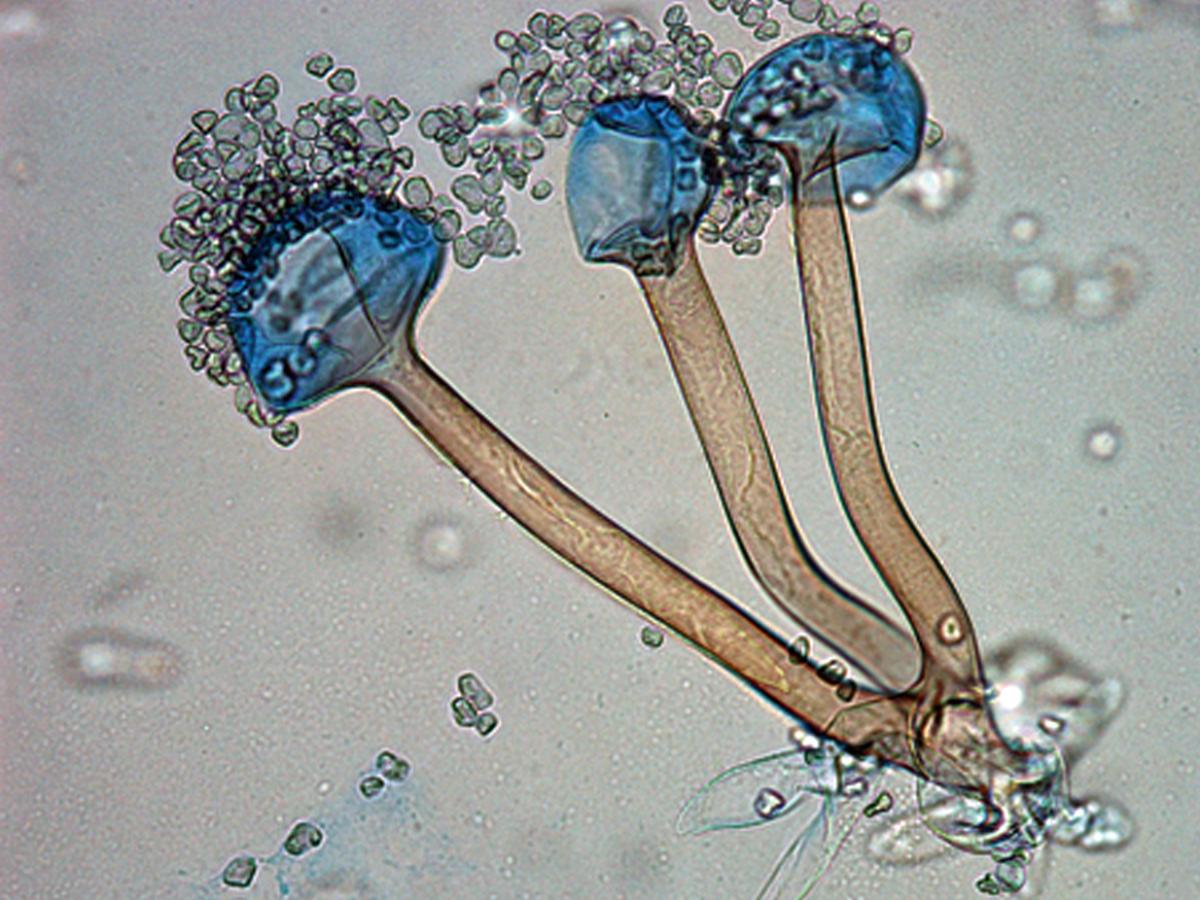 Rhizopus microsporus microscopy