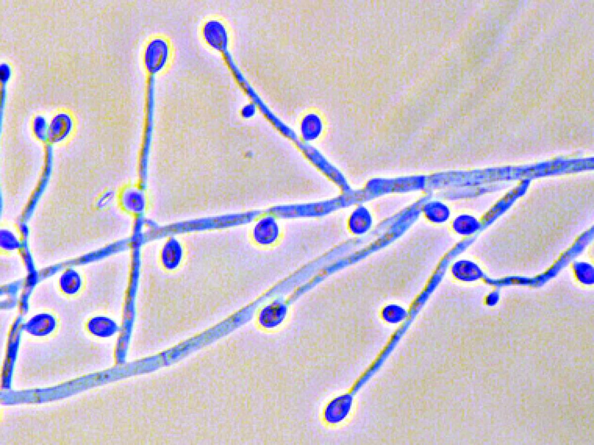 S. apiospermum microscopy