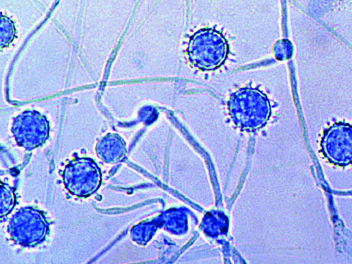 Sepedonium conidia