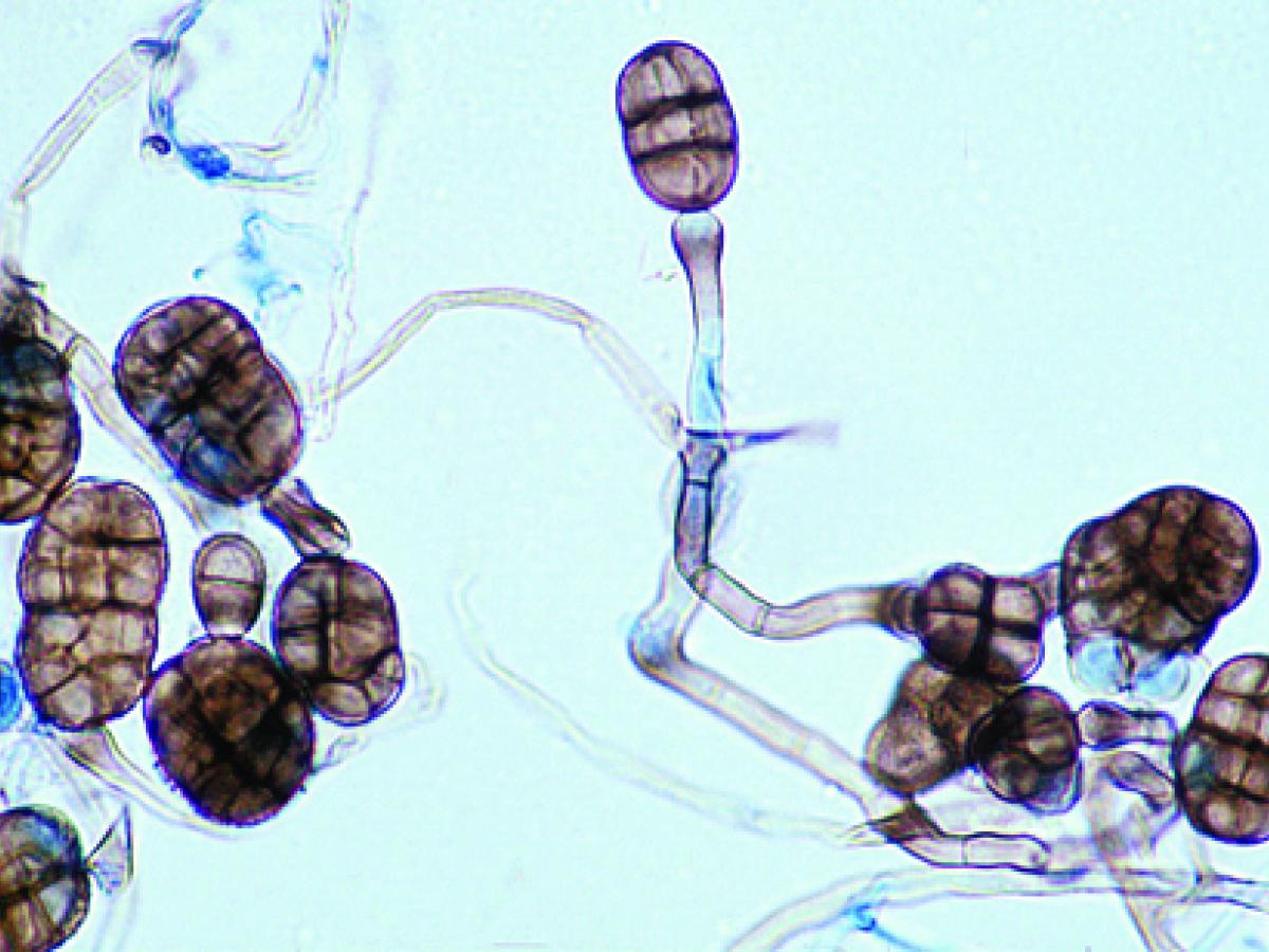 Stemphylium conidia