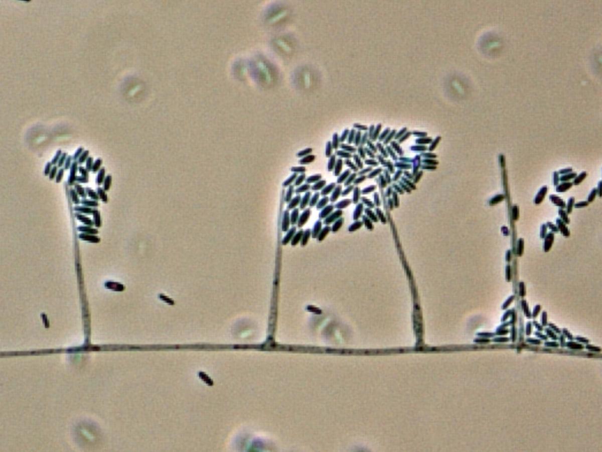 Sarocladium strictum morphology
