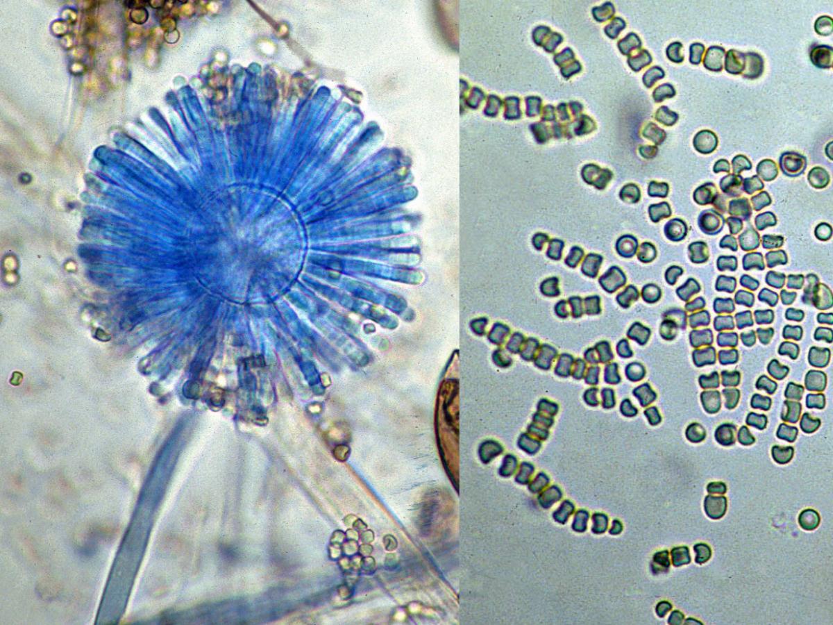 Syncephalastrum microscopy