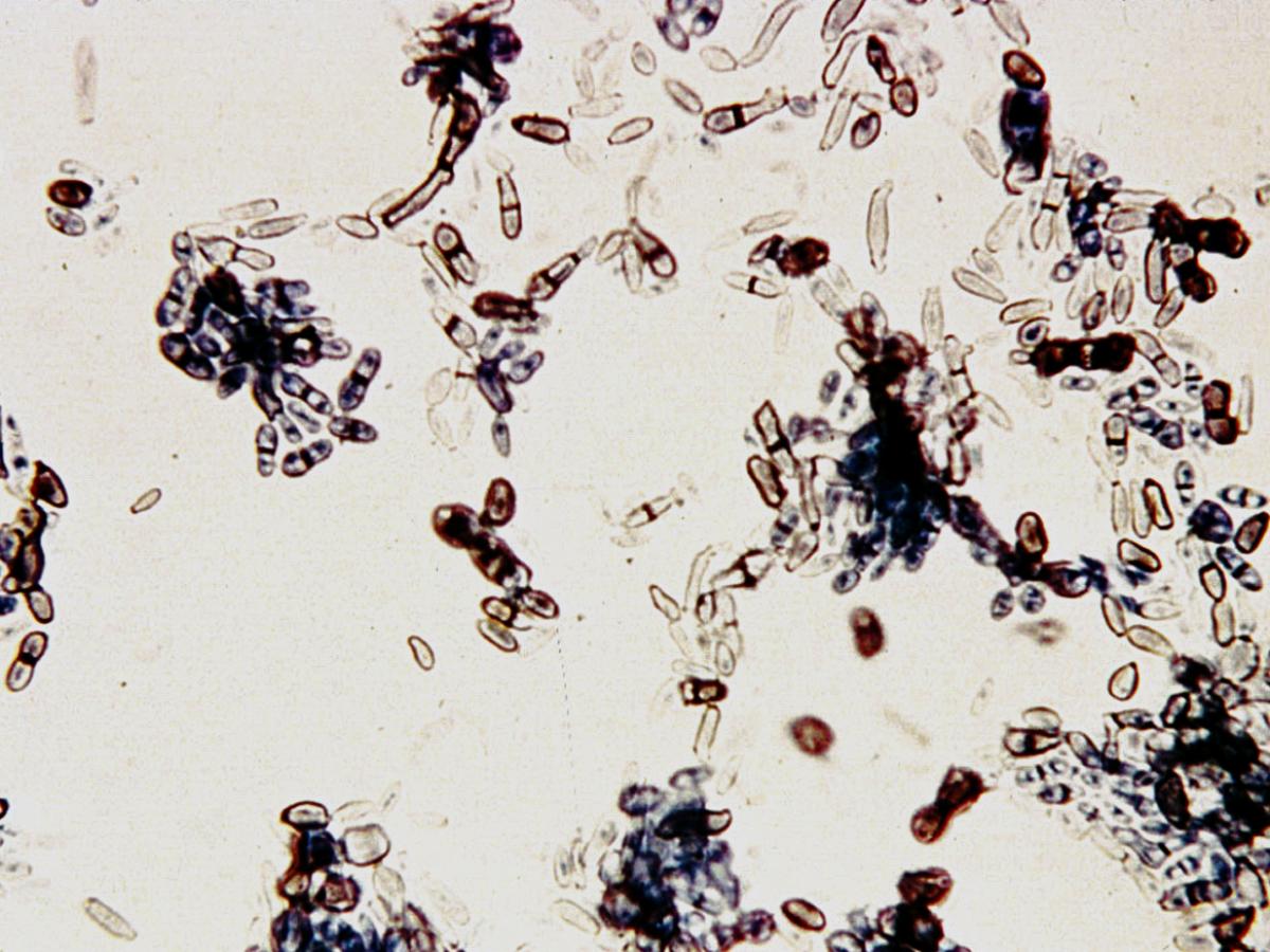 Tinea nigra microscopy