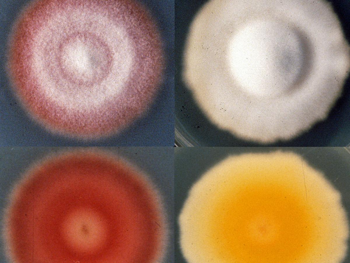 Trichophyton rubrum culture2