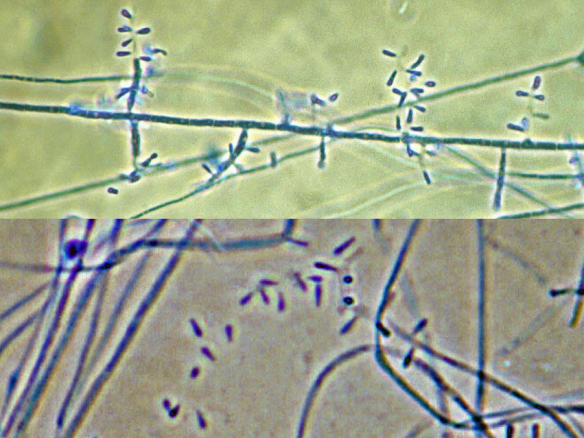 Trichophyton rubrum micro1