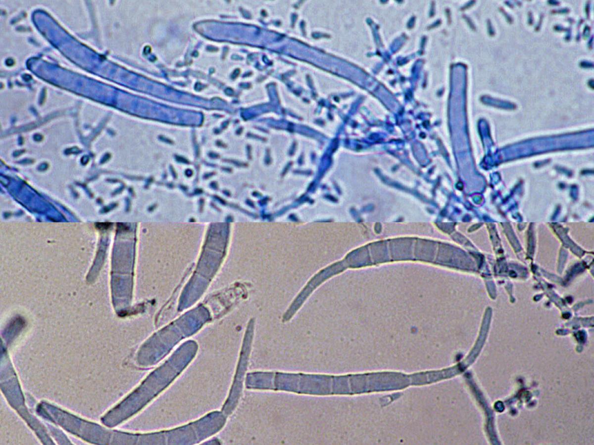 Trichophyton rubrum micro2