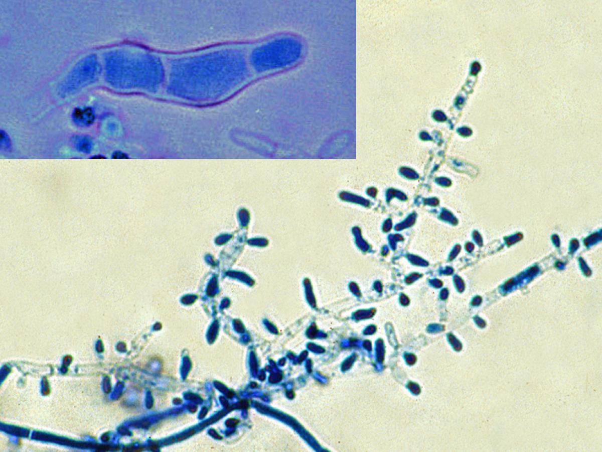 Trichophyton tonsurans microscopy