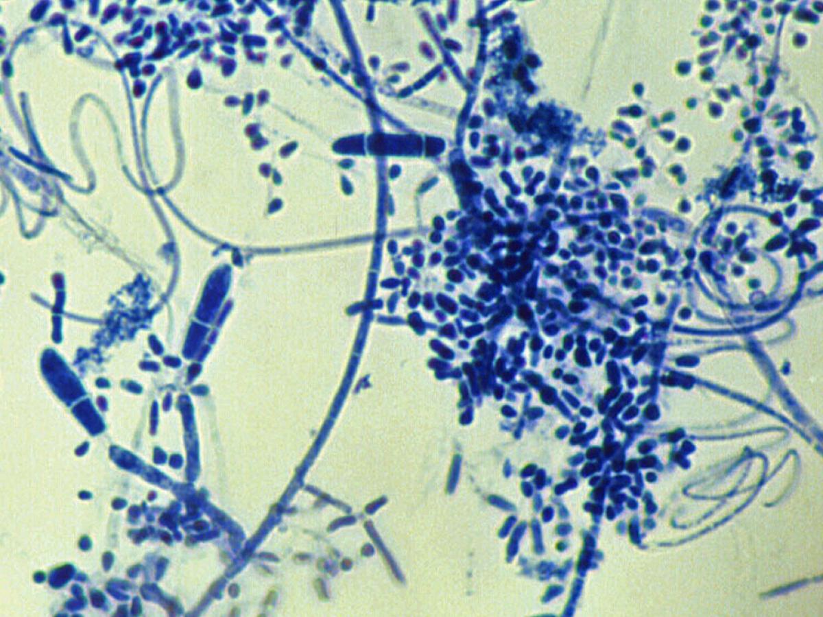 Trichophyton interdigital micro1