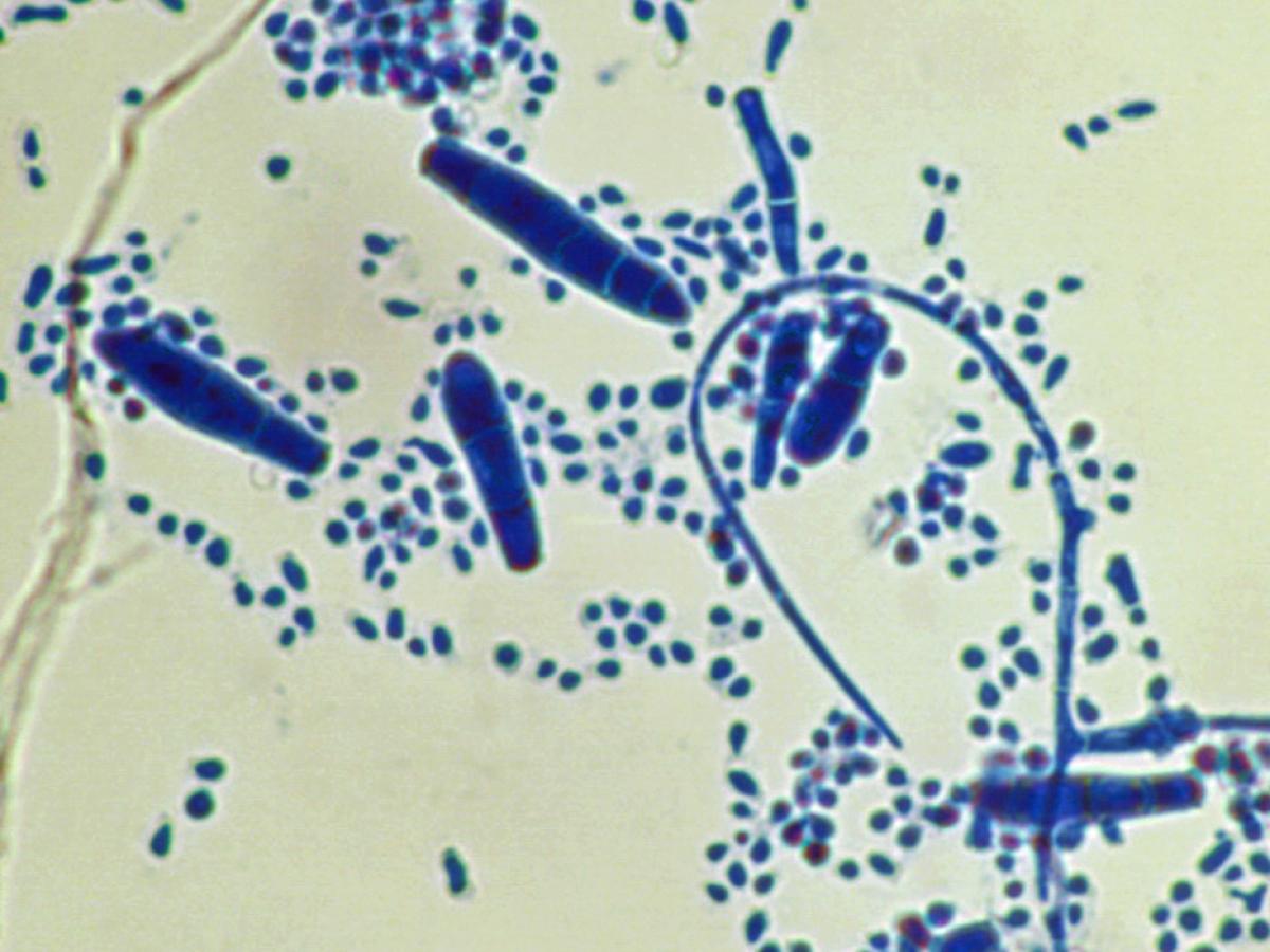 Trichophyton mentagrophytes microscopy1