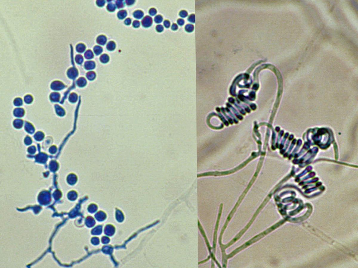 Trichophyton mentagrophytes microscopy2