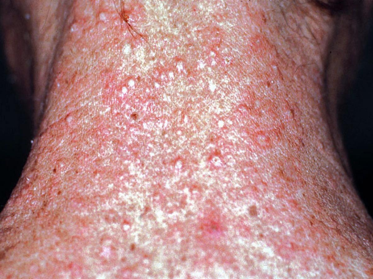 Unknown 10 clinical presentation