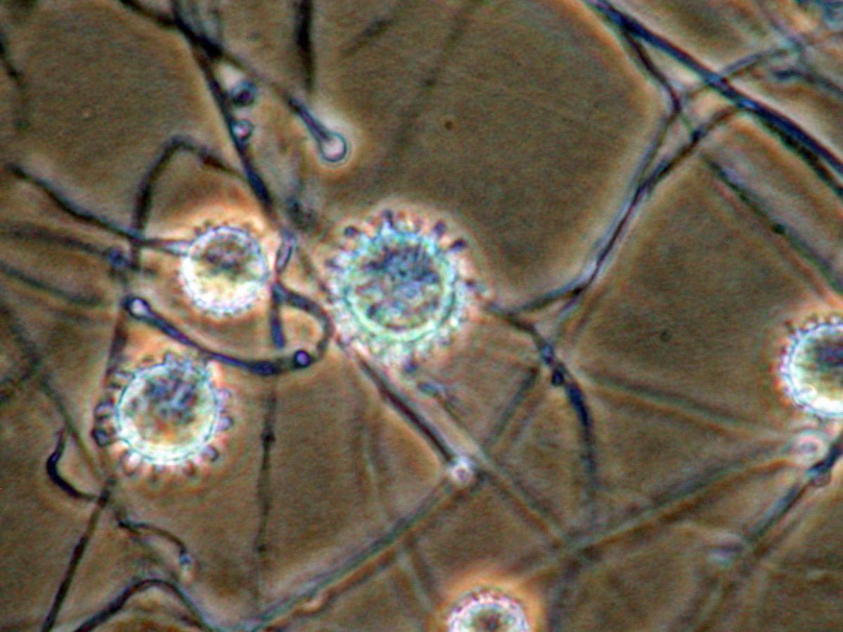 Unknown 13 microscopy - 2