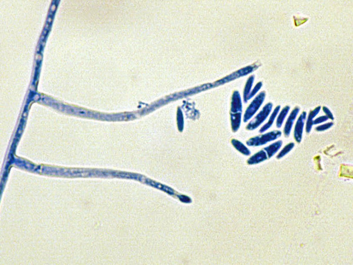 Unknown 14 microscopy - 1