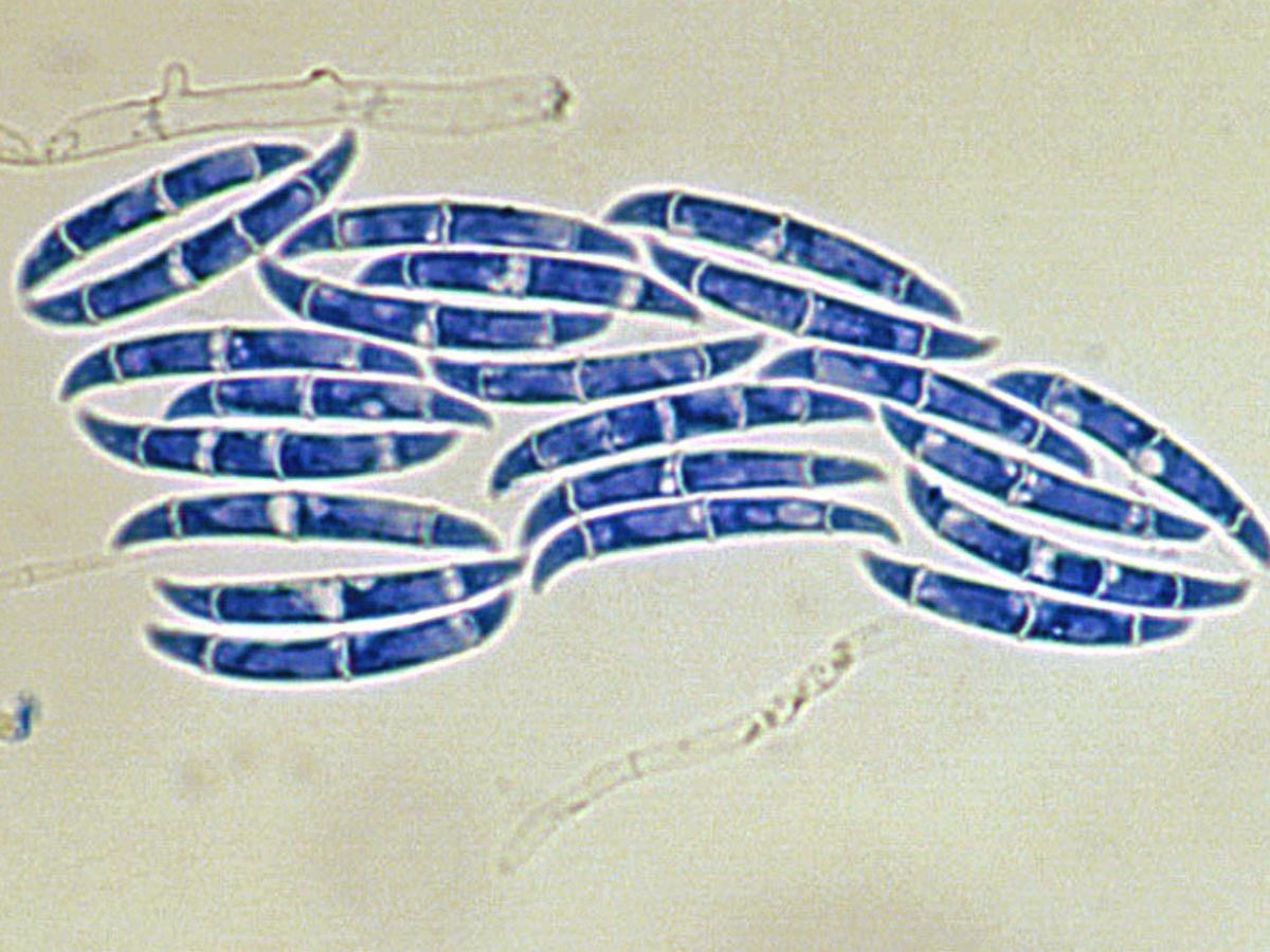 Unknown 14 microscopy - 2
