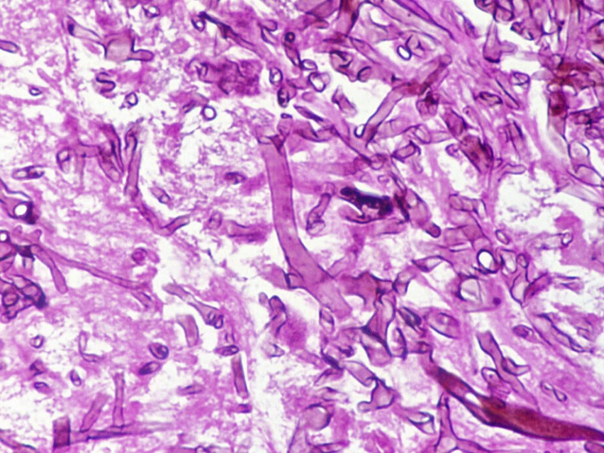 Unknown 15 direct microscopy (H&E stained tissue section)